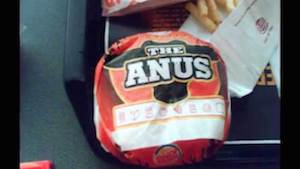 1anus